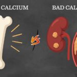 Good Calcium vs. Bad Calcium