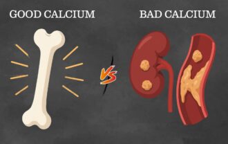 Good Calcium vs. Bad Calcium